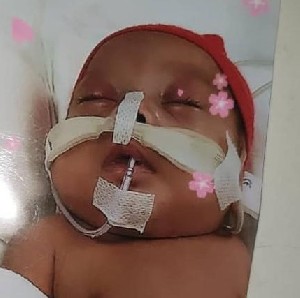 Tak Sanggup Lunasi Biaya, Bayi asal Nagan Raya Tertahan di Rumah Sakit di Malaysia